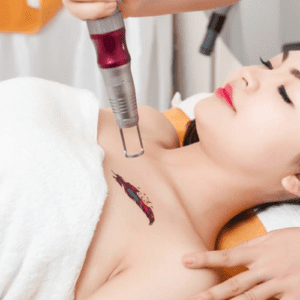 Xóa hình xăm Mita beauty
